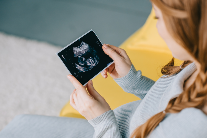 IUI inseminazione intra uterina